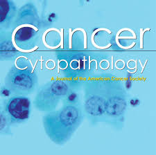 Comparison of 2 new real-time polymerase chain reaction-based urinary markers in the follow-up of patients with non-muscle-invasive bladder cancer