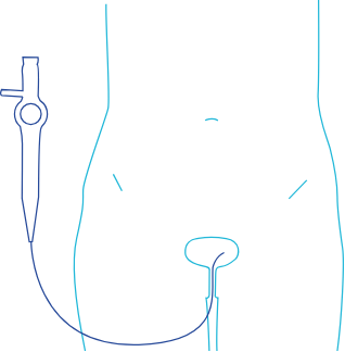 bladder illustration